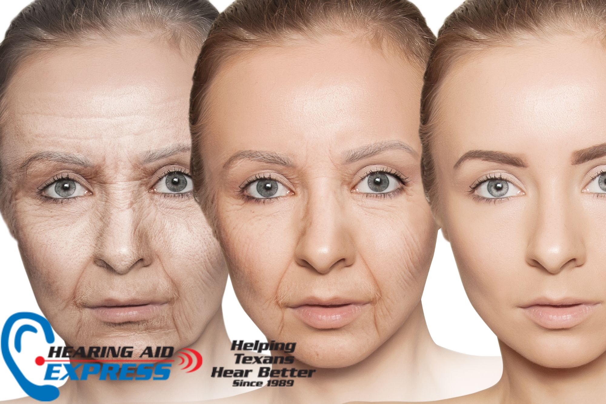 woman showing signs of aging